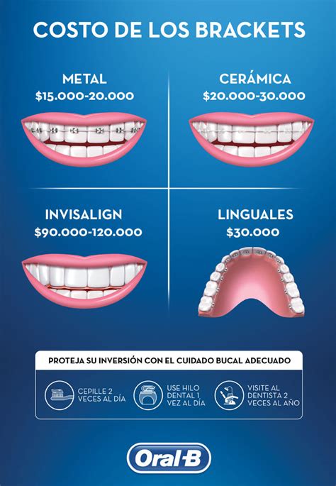 precio de las brackets